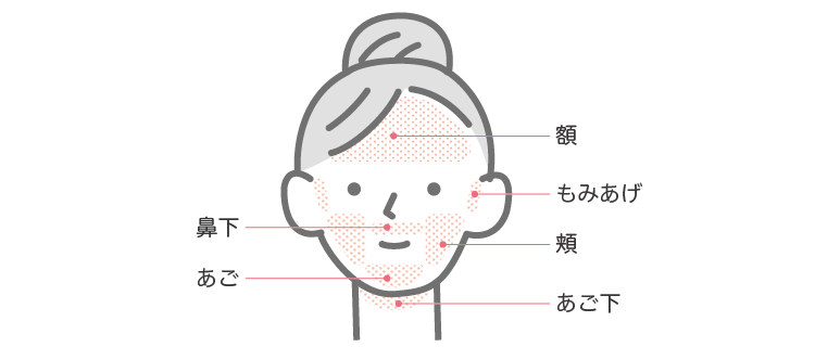 医療レーザー脱毛部位