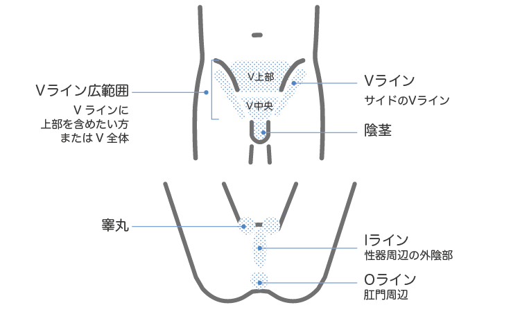 医療レーザー脱毛部位