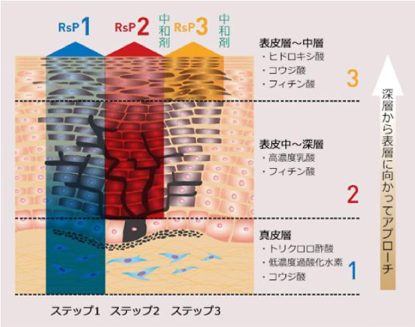 リバースピール